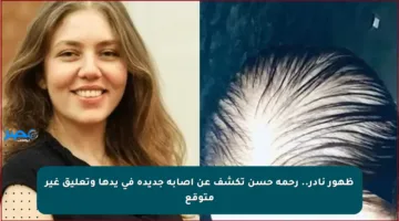 ظهور نادر.. رحمة حسن تكشف عن إصابة جديدة في يدها وتعليق غير متوقع